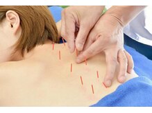 ことぶき整体院 武蔵浦和店/武蔵浦和で鍼ならことぶきへ