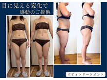 プロテュウス(PUROTUCE)の雰囲気（衝撃ビフォアフに話題殺到！肩こりなどのお疲れほぐしにも◎）