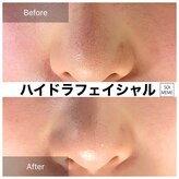 ビテキサロン ソワメーム(biteki salon SOI-MEME)