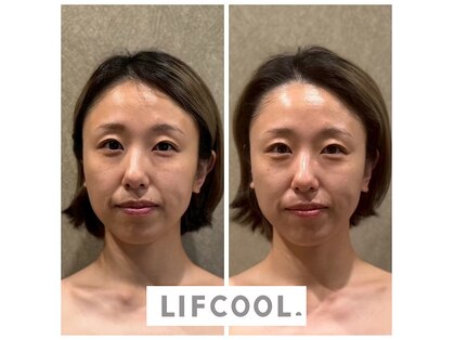 コアラル 麻布十番(COALALU)の写真