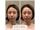 コアラル 麻布十番(COALALU)の写真