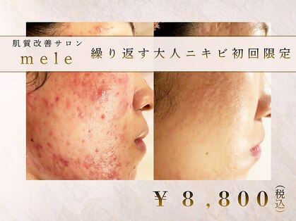 メレ(mele)の写真