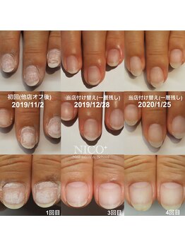 ニコプラス(NICO+)/パラジェルクリア補強