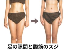 ニュートラル 池袋店(NEUTRAL)/施術結果【痩身/むくみ/痩せる】