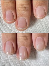 シュシュ(shou shou)/自爪育成