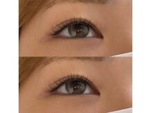 ロゼッティ(ROSETTY)/LEDフラット100本