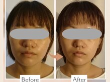 しましまの雰囲気（よもぎ+リンパ+フェイシャル☆1度の施術でもむくみスッキリ(^^)）