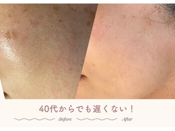 エステティックサロン シーズ/Q.40代からでも遅くない？