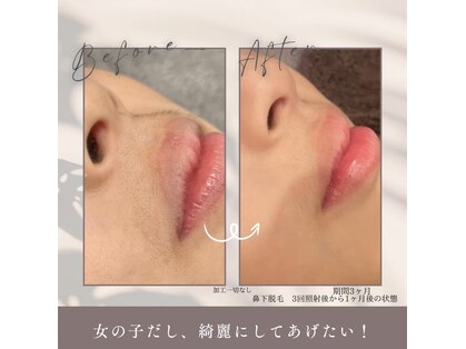 モア トゥインクル 倉敷店(MORE twinkle)の写真