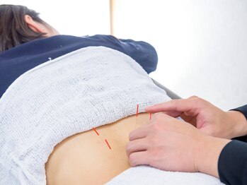 昭和鍼灸マッサージ　松戸店/