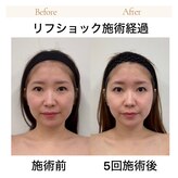 サンスタイルクリア 守山店(SUN STYLE CLEAR)