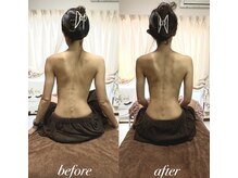 ラマジ(Lamazi)/背中・肩甲骨・肩周りケア