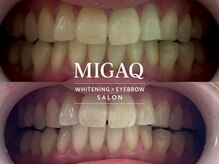 ミガク 京都四条大宮店(MIGAQ)の雰囲気（歯科医師監修、しみない、食事制限なし♪1回でも効果あり！）