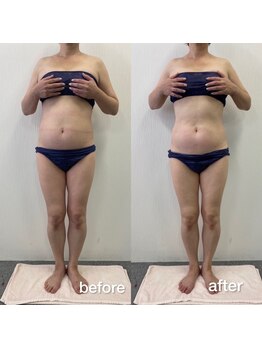 リラクラージュ(Ri Ra Courage)/ 50代2ヶ月後