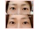 プリティアイ(pretty eye)の写真