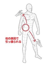筋膜は、全身ウエットスーツの様に１枚でつながっています。