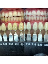 トウキョースワーズ 渋谷店(TOKYO SWRS)/#ホワイトニング #渋谷 #池袋