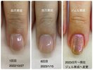 自爪育成→ジェル育成