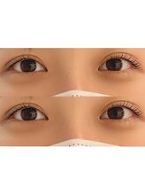 ユーロ(EURO)/ ラッシュリフト♪