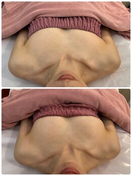 ハグミー(Hugme)/バストのお悩みお任せください!