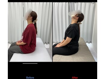 整体リアン 天神院(Lien)/ビフォーアフター:首の可動域