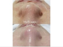 エムズビューティスタジオ エステ リラク 西川口店(M's Beauty Studio)