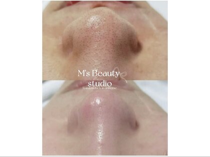 エムズビューティスタジオ エステ リラク 西川口店(M's Beauty Studio)の写真