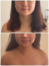 アミナス(Total Beauty Salon AMINAS)/華奢みえコルギ