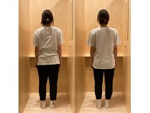 てとね鍼灸整骨院の雰囲気（姿勢改善に自信あり。まずは姿勢改善カウンセリングで分析分析！）