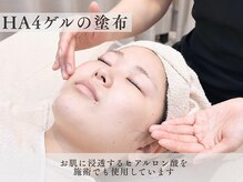 ムク 大宮店(MUQU)/HA4ゲルの塗布