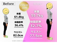 鍼灸整骨院ゼット(Z)/61キロから55キロダイエット成功