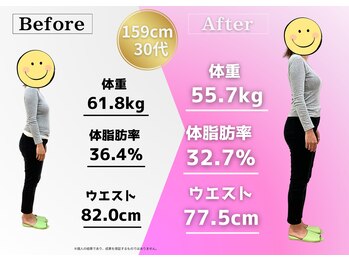 鍼灸整骨院ゼット(Z)/61キロから55キロダイエット成功