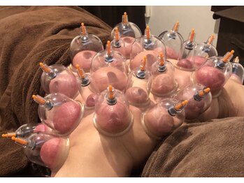 サロンリーナ 銀座店(SalonLena)/カッピング筋膜リリース