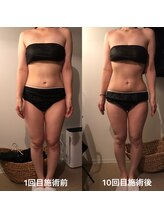 エイジングケアサロン 青山 本店/驚きのビフォア・アフター