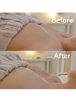 エレナ 伊勢崎(Ele'na)/左右差、削げ胸でお悩みの方に!