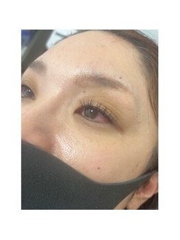 アイラッシュ サロン ブルーミング(Blooming)/フラットラッシュ 120本