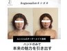 【人気NO1】最先端小顔術× 輪郭矯正術×美鼻矯正術　　