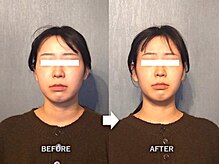 アトラス/初回のお客様のBefore＆after