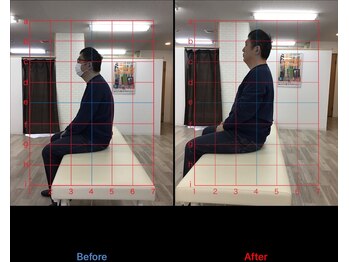 ストレチックス 近江八幡店/BeforeAfter