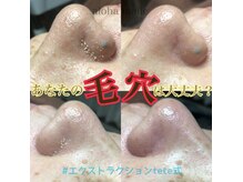 アロハマリエ(aloha malie)の雰囲気（癒しだけじゃないお悩み解決の結果にこだわるサロン！）