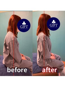 ギフトリラクゼーション 久留米(GIFTリラクゼーション)/☆before after☆