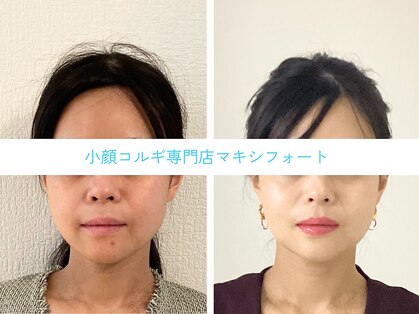 コルギ専門店 マキシフォート 栄店(Maxifort)の写真