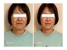 ベルソー(Berceau)/