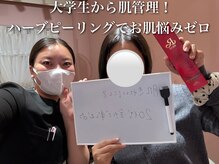 ホワイトアクア 梅田本店(WHITE AQUA)/ハーブピーリング/大阪/梅田