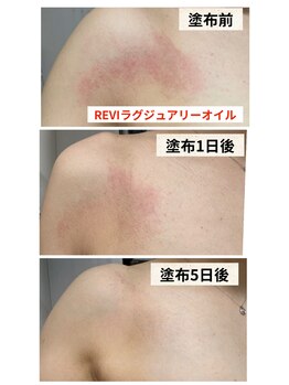 サロン ド プリリ(Salon de Puriri)/鎮静効果のラグジュアリーオイル