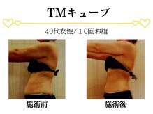 スパイア(SPIRE)/TMキューブ