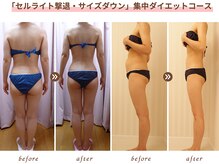 ベルタ 仙台店(BELTA)の雰囲気（最短で着実に♪短期集中ダイエットで速攻サイズダウンへ！）