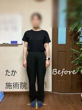 たか施術院/頭が痛い 背中の痛み 20代 ～3回