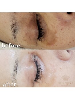 オレアグリーン 岡崎(OLEA green)/ブラックハーブ(たるみケア/岡崎