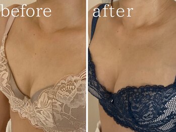 フォー(For...)/バストアップbefore/after